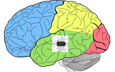 Un implant pour augmenter votre mémoire?